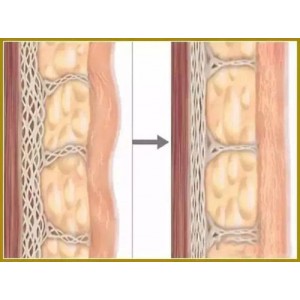 了解筋膜：从定义到预防，1-6步认识你的身体